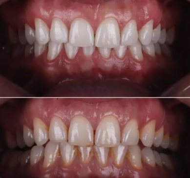 Slider image (4) Smile Zone Clinic